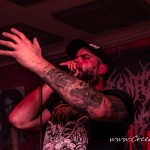 0013 Congenital Anomalies